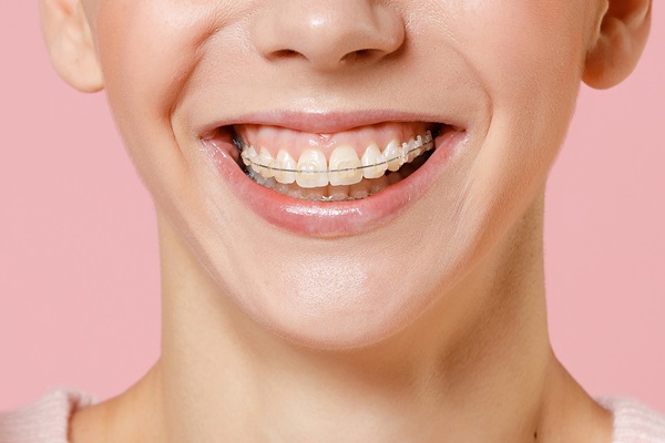 How An Orthodontist Can Help Correct Your Bite And Alignment Issues